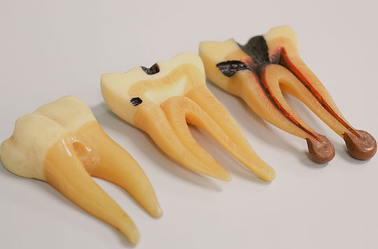 Treatment - Earley Dental Practice